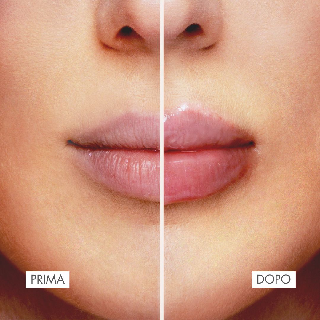 LIP PLUMPER | BALSAMO LABBRA RIMPOLPANTE