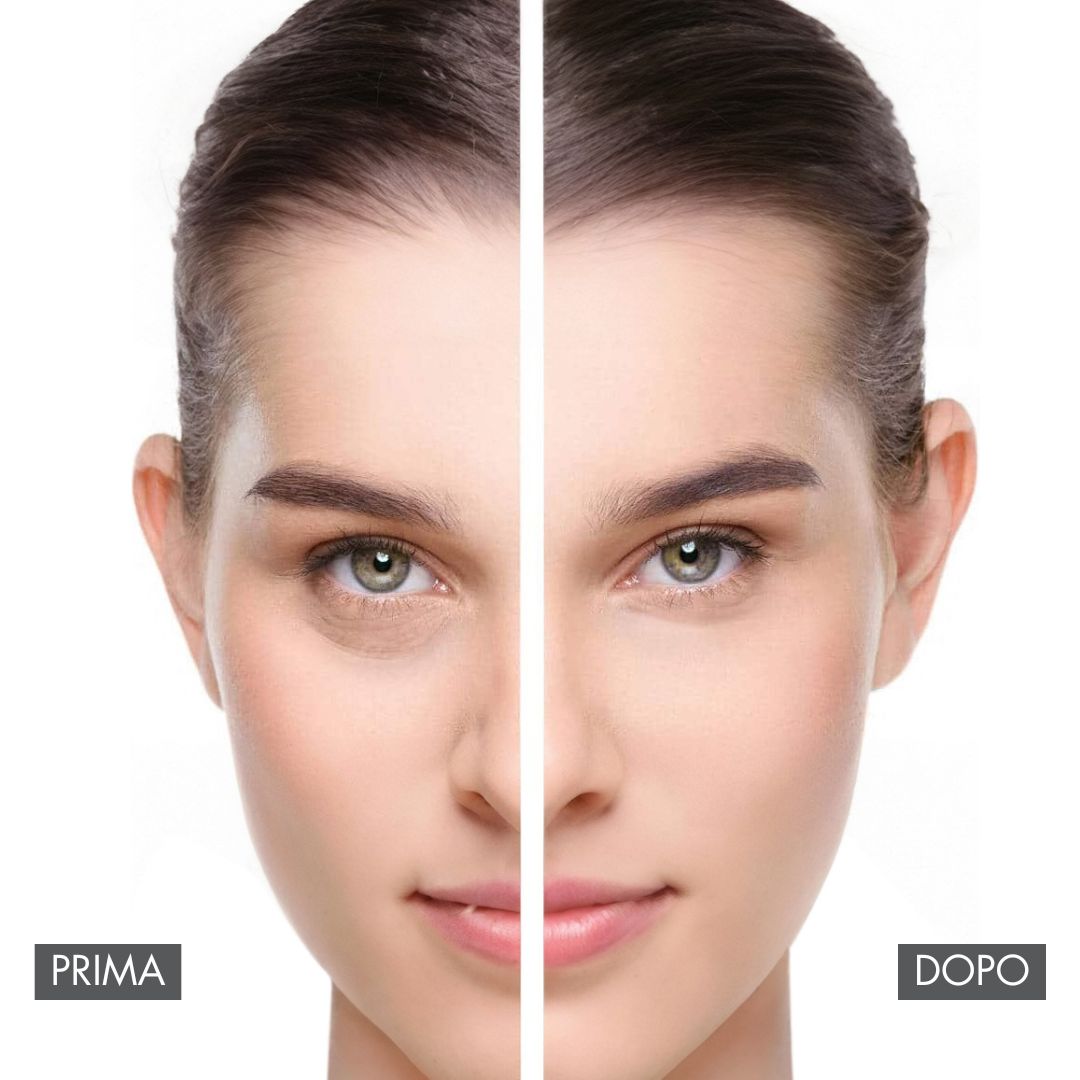 SOYSOY JALURACTIVE CONTORNO OCCHI PER BORSE E OCCHIAIE